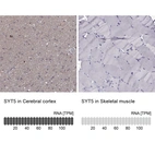 Anti-SYT5 Antibody