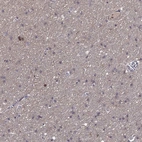 Immunohistochemical staining of human cerebral cortex shows high expression.