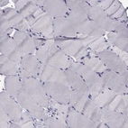 Immunohistochemical staining of human skeletal muscle shows low expression as expected.