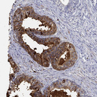 Immunohistochemical staining of human prostate shows strong membranous and cytoplasmic positivity in glandular cells.