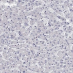 Immunohistochemical staining of human liver shows no positivity in hepatocytes.
