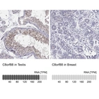 Anti-C8orf88 Antibody