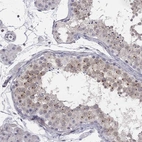 Immunohistochemical staining of human testis shows high expression.