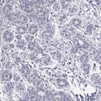 Immunohistochemical staining of human breast shows low expression as expected.