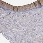 Anti-EMILIN3 Antibody