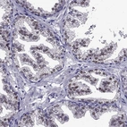 Immunohistochemical staining of human prostate shows strong nuclear positivity in glandular cells.