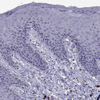 Immunohistochemical staining of human skin shows no positivity in squamous epithelial cells as expected.