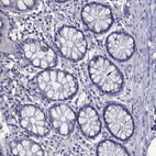Immunohistochemical staining of human colon shows no positivity in glandular cells as expected.