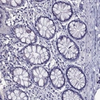 Immunohistochemical staining of human colon shows no positivity in glandular cells as expected.