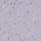 Immunohistochemical staining of human cerebral cortex shows no positivity in neurons as expected.