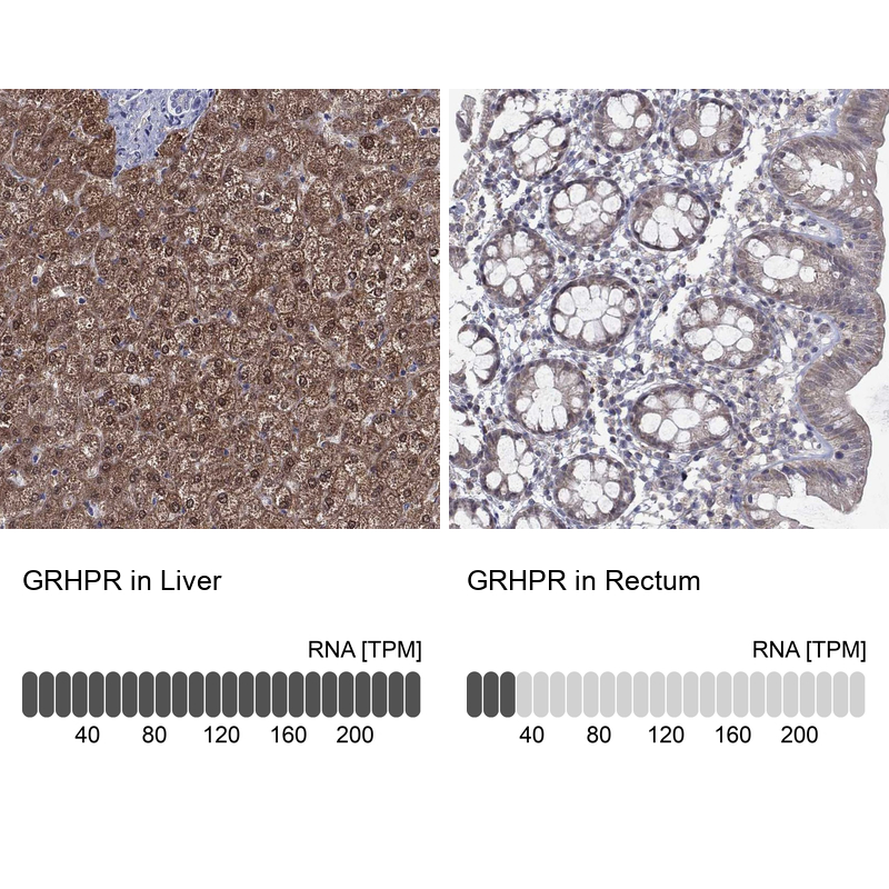 Anti-GRHPR Antibody