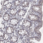Immunohistochemical staining of human rectum shows low expression as expected.
