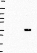 Lane 1: Marker [kDa] 250, 130, 95, 72, 55, 36, 28, 17, 10 | Lane 2: RT4 | Lane 3: U-251 MG | Lane 4: Human Plasma | Lane 5: Liver | Lane 6: Tonsil