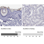 Anti-ALOXE3 Antibody