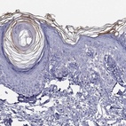 Immunohistochemical staining of human skin shows high expression.