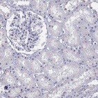 Immunohistochemical staining of human kidney shows low expression as expected.