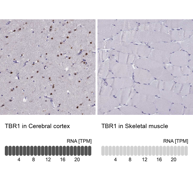 Anti-TBR1 Antibody