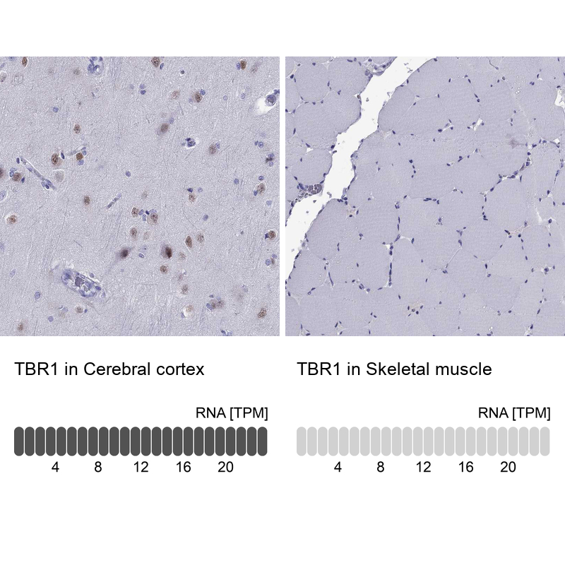 Anti-TBR1 Antibody