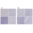 Immunohistochemical staining of human cerebral cortex, liver, pancreas and skeletal muscle using Anti-TBR1 antibody HPA078657 (A) shows similar protein distribution across tissues to independent antibody HPA078644 (B).