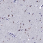 Immunohistochemical staining of human cerebral cortex shows moderate nuclear positivity in neurons.