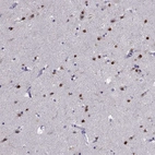 Immunohistochemical staining of human cerebral cortex shows strong nuclear positivity in neurons.
