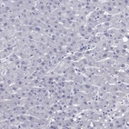 Immunohistochemical staining of human liver shows negative positivity in hepatocytes as expected.