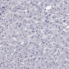 Immunohistochemical staining of human liver shows negative positivity in hepatocytes as expected.