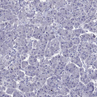 Immunohistochemical staining of human pancreas shows negative positivity in exocrine glandular cells as expected.