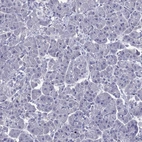 Immunohistochemical staining of human pancreas shows negative positivity in exocrine glandular cells as expected.