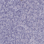 Anti-TBR1 Antibody