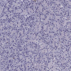 Immunohistochemical staining of human pancreas shows negative positivity in exocrine glandular cells as expected.