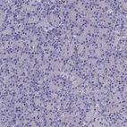 Immunohistochemical staining of human pancreas shows negative positivity in exocrine glandular cells as expected.