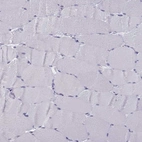 Immunohistochemical staining of human skeletal muscle shows negative positivity in myocytes as expected.