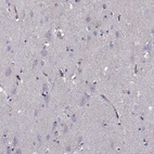 Immunohistochemical staining of human cerebral cortex shows low expression as expected.