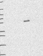 Lane 1: Marker [kDa] 250, 130, 95, 72, 55, 36, 28, 17, 10 | Lane 2: RT4 | Lane 3: U-251 MG | Lane 4: Human Plasma | Lane 5: Liver | Lane 6: Tonsil