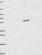 Lane 1: Marker [kDa] 250, 130, 95, 72, 55, 36, 28, 17, 10 | Lane 2: RT4 | Lane 3: U-251 MG | Lane 4: Human Plasma | Lane 5: Liver | Lane 6: Tonsil