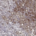 Anti-CERS2 Antibody