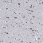 Anti-MMP24 Antibody