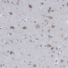 Anti-MMP24 Antibody