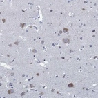 Anti-SLC45A1 Antibody