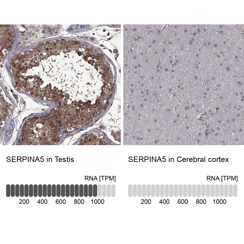 Anti-SERPINA5 Antibody