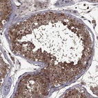 Immunohistochemical staining of human testis shows high expression.