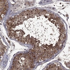 Immunohistochemical staining of human testis shows high expression.