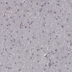 Immunohistochemical staining of human cerebral cortex shows low expression as expected.