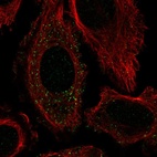 Anti-FTCDNL1 Antibody