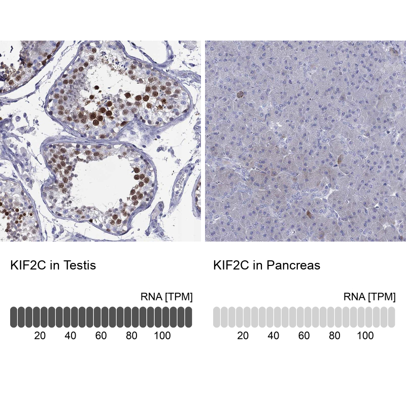 Anti-KIF2C Antibody