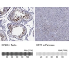 Anti-KIF2C Antibody
