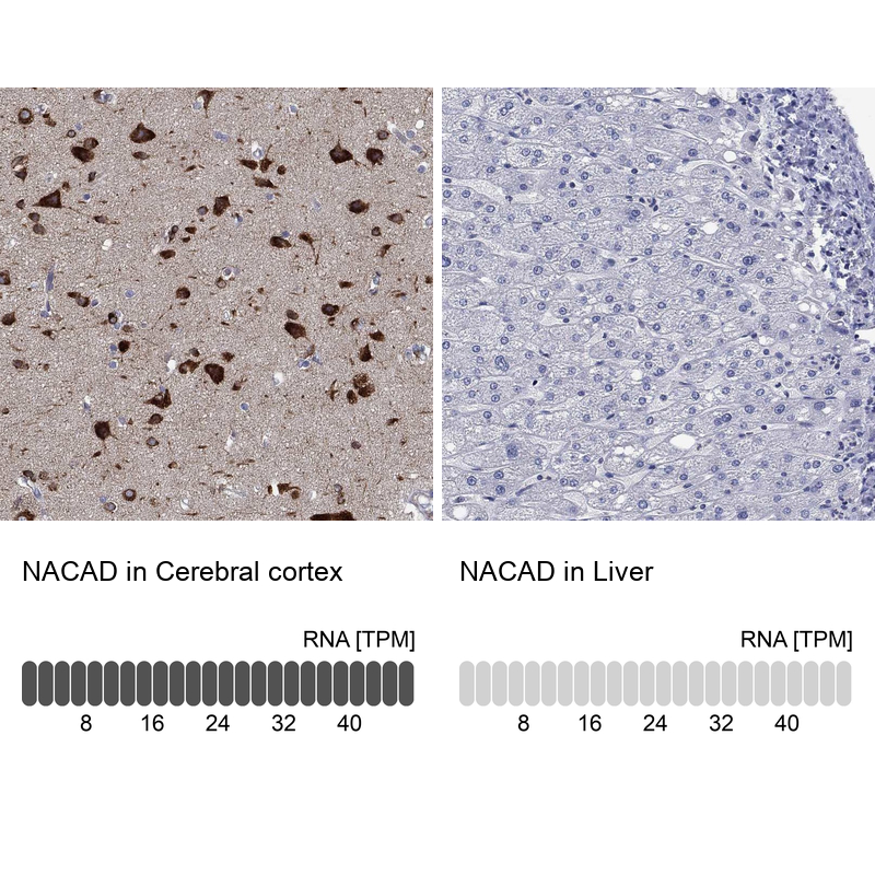 Anti-NACAD Antibody