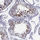 Immunohistochemical staining of human testis shows high expression.