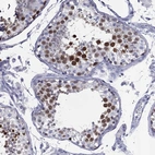 Immunohistochemical staining of human testis shows high expression.